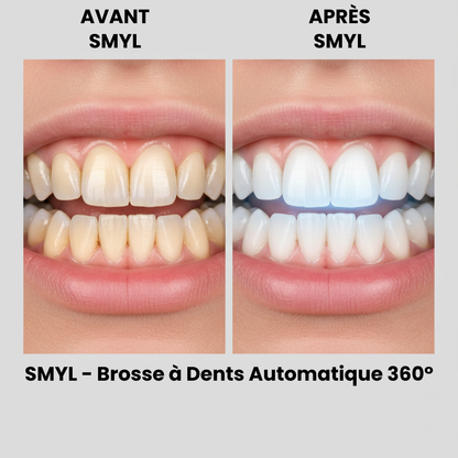 U-Type Toothbrush 360 Degrees Intelligent Silicon Head Sonic Electric Toothbrush Automatic USB Charge Waterproof Toothbrush